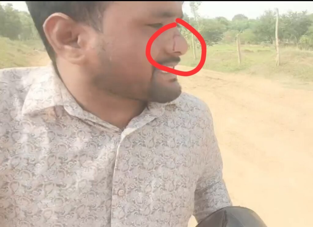 गरियाबंद रेत खदान में पत्रकारों पर हमला